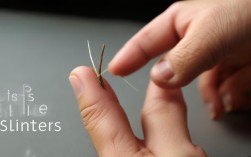 生活常识倒刺怎么处理才不疼不复发？