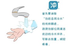 如何有效掌握防止烫伤的安全常识，避免日常生活中的意外烫伤风险？