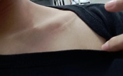 身上有疤痕国考能通过体检吗？