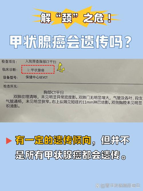 甲状腺癌国考是什么?为何要考?-图2 甲状腺癌国考是什么?为何要考?-图2