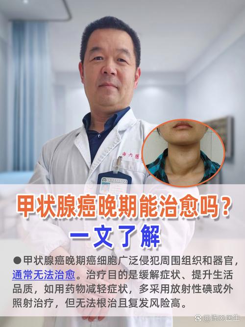 甲状腺癌国考是什么?为何要考?-图3 甲状腺癌国考是什么?为何要考?-图3