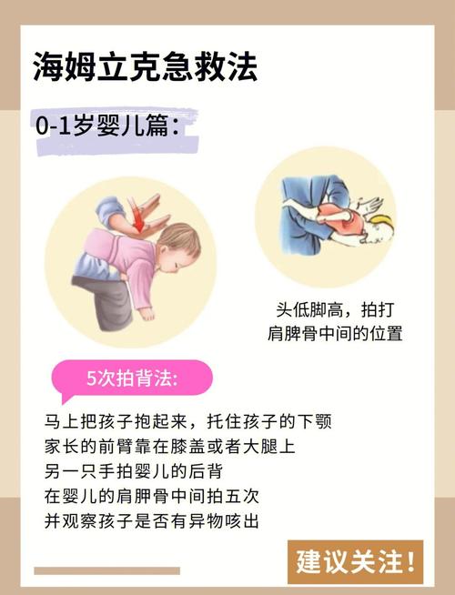 婴儿急救常识PPT,关键急救步骤如何快速掌握与正确应用?-图3 婴儿急救常识PPT,关键急救步骤如何快速掌握与正确应用?-图3