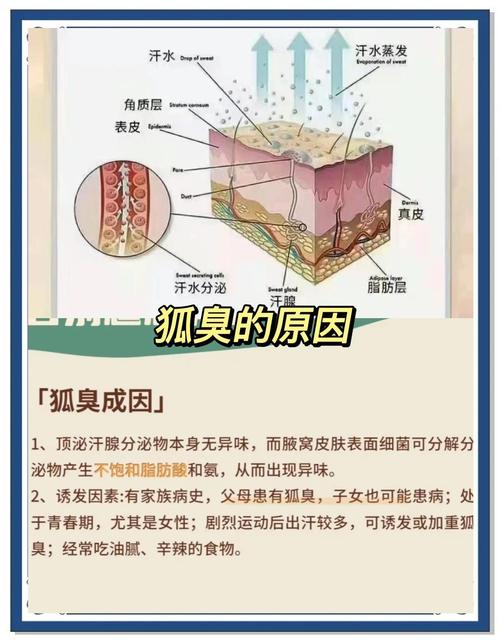黑龙江男性狐臭常识，这些诱因和护理方法你都知道吗？-图1
