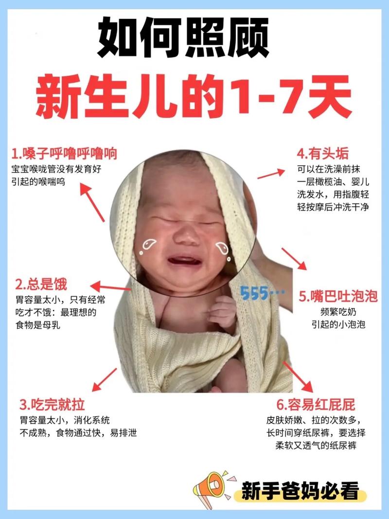 婴儿刚出生护理常识-图2